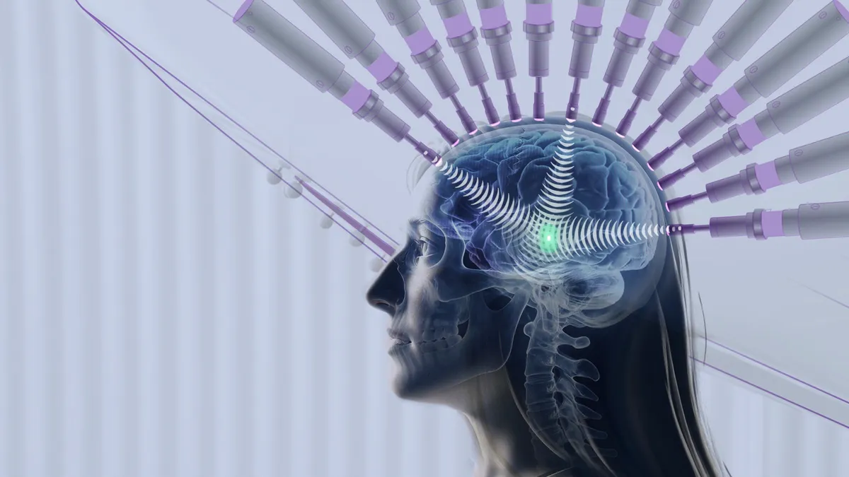 Stylised illustration of a translucent human head in profile showing the brain, surrounded by a fan of transducer cylinders; wave arcs converge on a small glowing point deep inside the brain.